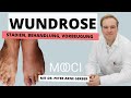 The Best 26 Wundrose Ansteckend