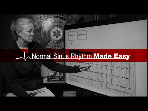 Normal Sinus Rhythm EKG Made Easy