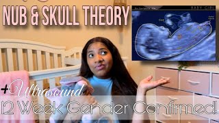 12 Week Ultrasound Baby Gender Prediction ITS A GIRL!🎀 Nub Theory & Skull Theory, Gender Reveal