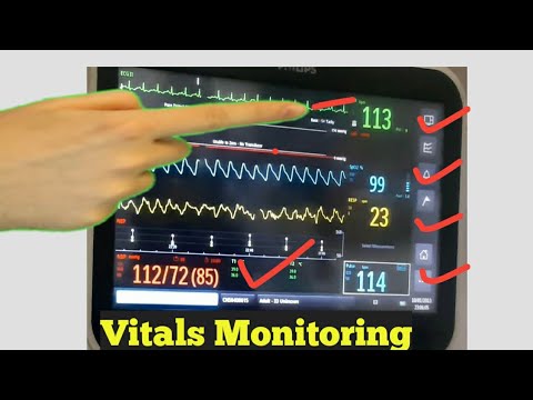 ICU Monitors Guide in hindi part 2 | Vital Monitoring with Digital Monitor | How to Monitor Vitals