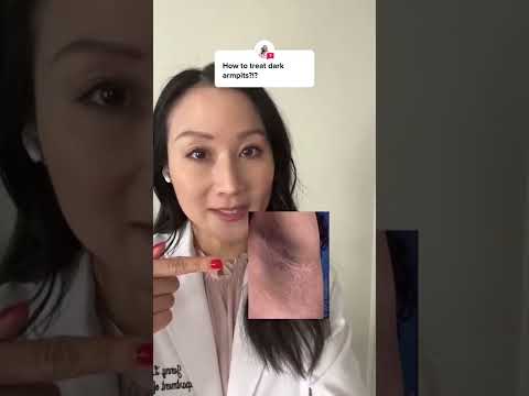Causes of Dark Armpits | Dermatologist Tips #SHORTS