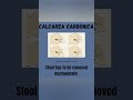 Calcarea Carbonica Stool Key Points Important Notes