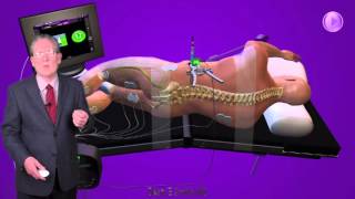 Minimally Invasive Spine SurgeryVideo In India Minimally Invasive Spine SurgeryVideo In India