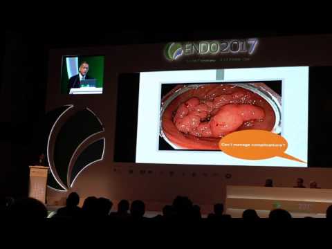 Colonoscopy: BJ Vakil Oration at 1st World Congress of GI Endoscopy
