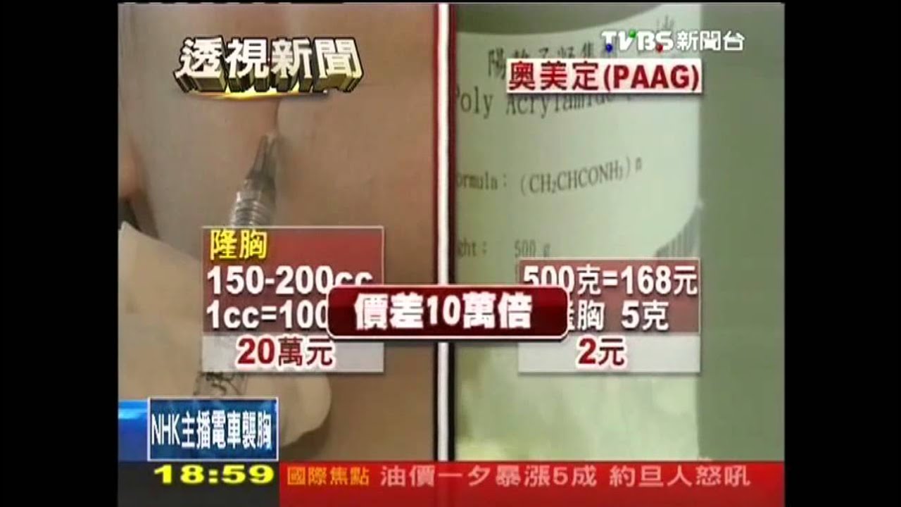 「奧美定」豐胸違法! 主做矽利康抓漏