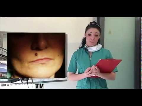 Il pigmentary nota su una faccia di una fotografia Lentiggine di competizione da bambini