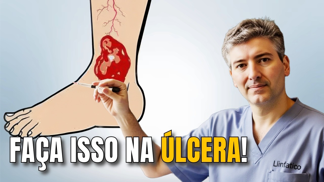 Quais os Cuidados no Tratamento da Úlcera Venosa?