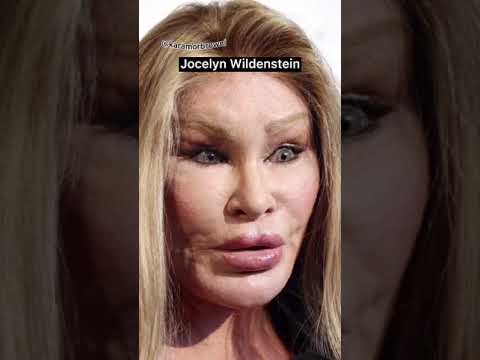 Estetik Ameliyat Faciaları 😱