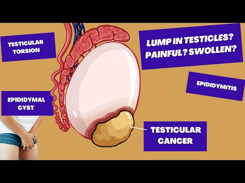 I've found A Lump In My Testicle, Could It Be TESTICULAR CANCER? | Causes of Testicular Pain/Lumps