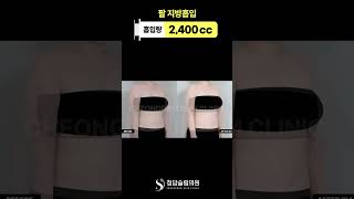 팔라인 차이 꽤 큰데? 👀