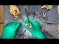 Sarah Patterson Model Surgery Video