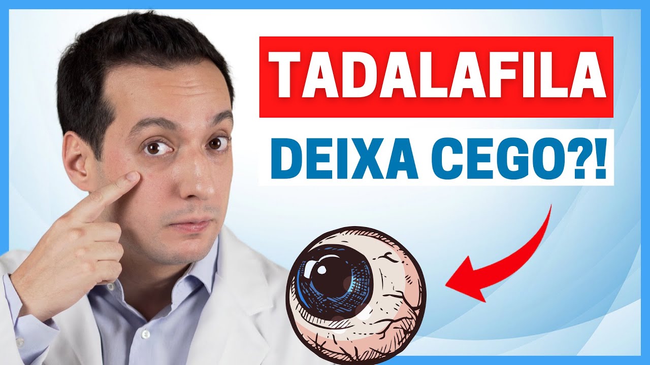 TADALAFILA E PROBLEMAS OCULARES: DESCUBRA OS 5 EFEITOS COLATERAIS NA VISÃO QUE VOCÊ NÃO PODE IGNORAR