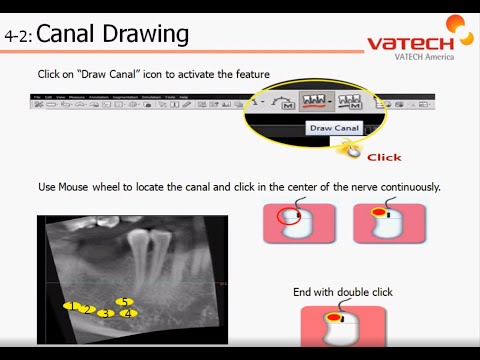 Canal Draw