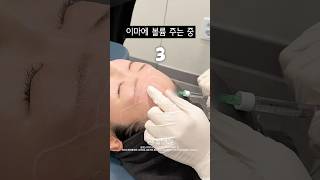 이마 볼륨으로 윤곽 또렷해지기💯