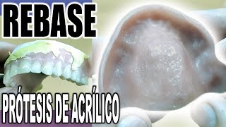 CÓMO HACER UN REBASE A UNA PRÓTESIS DENTAL DE ACRÍLICO PASO A PASO