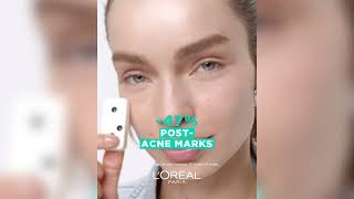 L'Oréal Bright Reveal Exfoliant Peel | Before & After