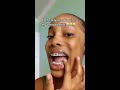 She Broke Her Braces And Did WHAT Orthodontist Reacts