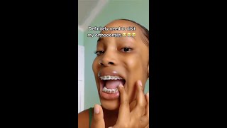 She Broke Her Braces And Did WHAT?!?! 😳 Orthodontist Reacts