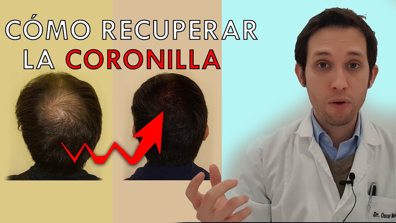RECUPERA TU CORONILLA