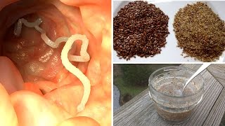 How to Get Rid of Intestinal Parasites (recipe) | Natural Cures