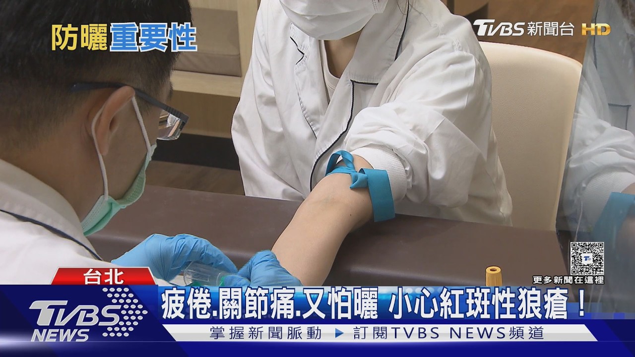 女性罹紅斑性狼瘡是男性7倍！醫師：出現「這5大症狀」別只當過敏
