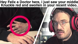 If you want the whole video start at - Doctor Reacts To my Injury (serious) - LWIAY #00142