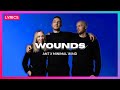 Ant & Minimal Wind - Wounds (Don't Wanna Fall) | Eesti Laul 2026 🇪🇪 (Lyrics Video)