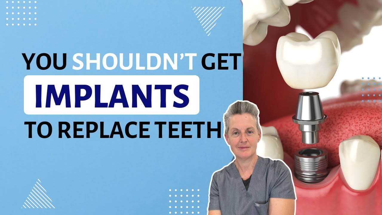 Don't Get Screwed! Here's Why You Shouldn't Get Dental Implants
