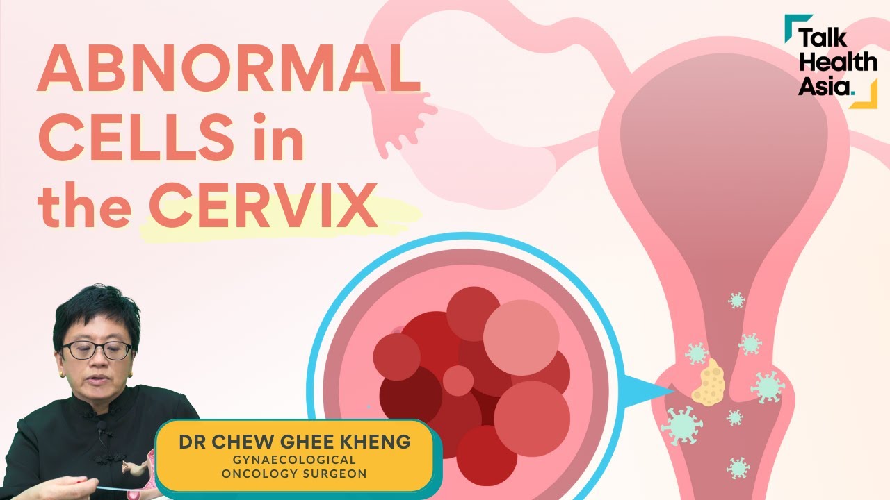 Abnormal Cells in Your Cervix - 6 Must-Knows | Dr Chew Ghee Kheng