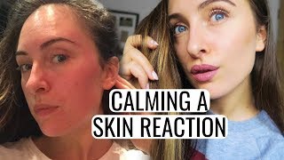 HOW TO CALM A SKIN REACTION - Tiny Bumps, Redness, Cystic Acne and more!
