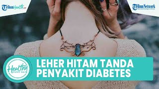 Waspadai Leher Hitam Bisa Jadi Tanda Penyakit Diabetes Akut, Begini Penyebab dan Cara Mengatasinya