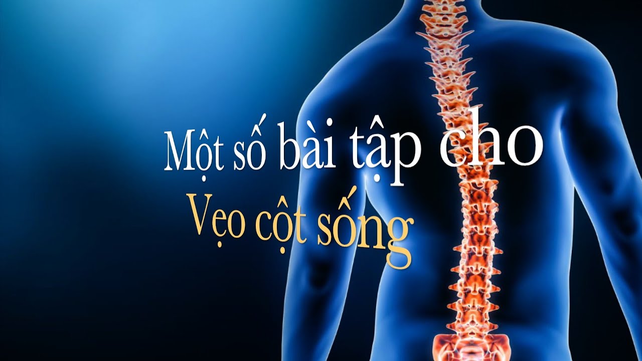 Một số bài tập cho Vẹo cột sống