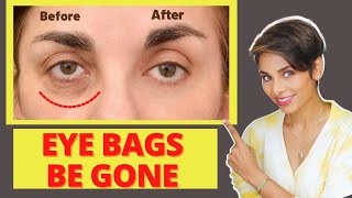 Inexpensive Ways To Get Rid of BAGS UNDER YOUR EYES Naturally/ Home Remedies