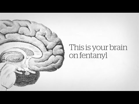 How fentanyl kills: A CBC News explainer