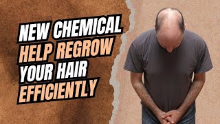 Download the video "This New Chemical Help Regrow Your Hair 😳 #hairloss #biology #chemistry #viralvideo #haircare "