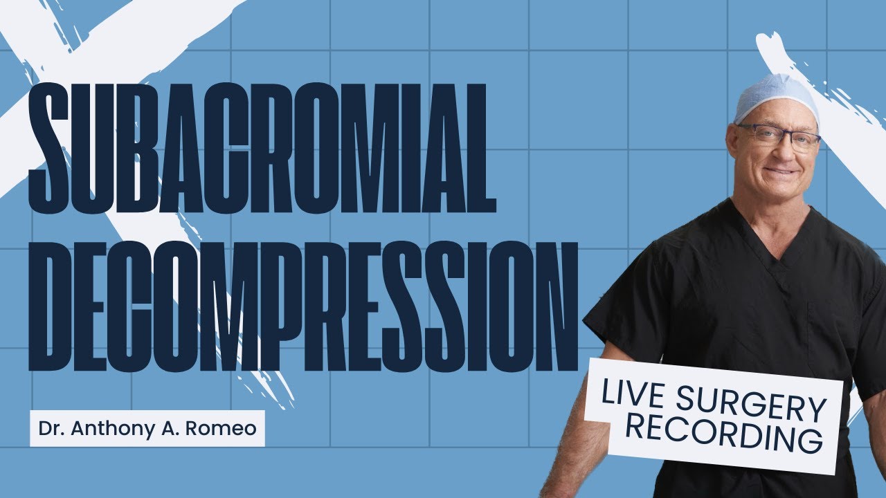 Subacromial Decompression