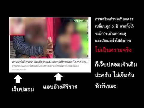เต้านมเทียมสำหรับ 225 มล. อาหารเสริมเต้านม