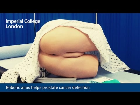 Robotic anus helps prostate cancer detection