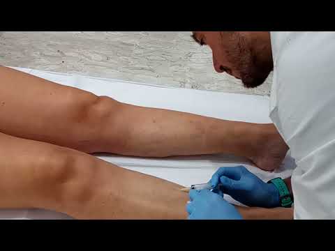 Lorenzo Marocchi-9