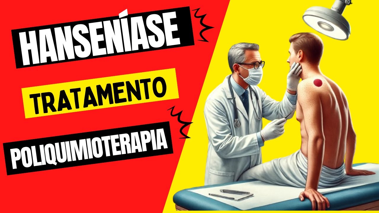 Tratamento da Hanseníase #hanseníase