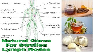 Natural Cures For Swollen Lymph Nodes