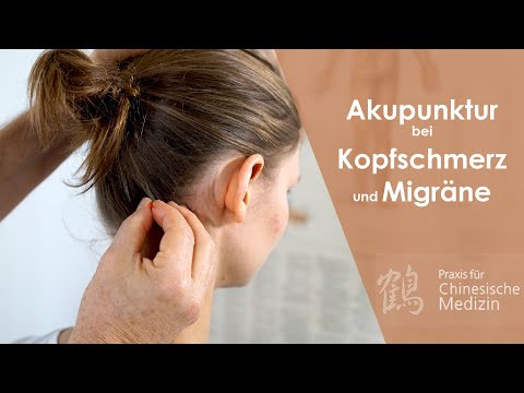 Akupunktur bei Kopfschmerz und Migräne - Behandlung mit Chinesischer Medizin