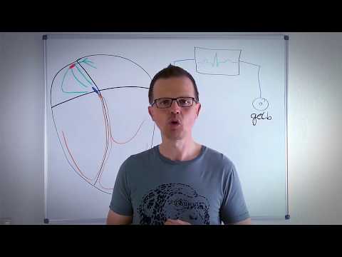 EKG-Lehrstunde: Die Vektorengesetze und ihre Bedeutung für die EKG-Blickdiagnostik