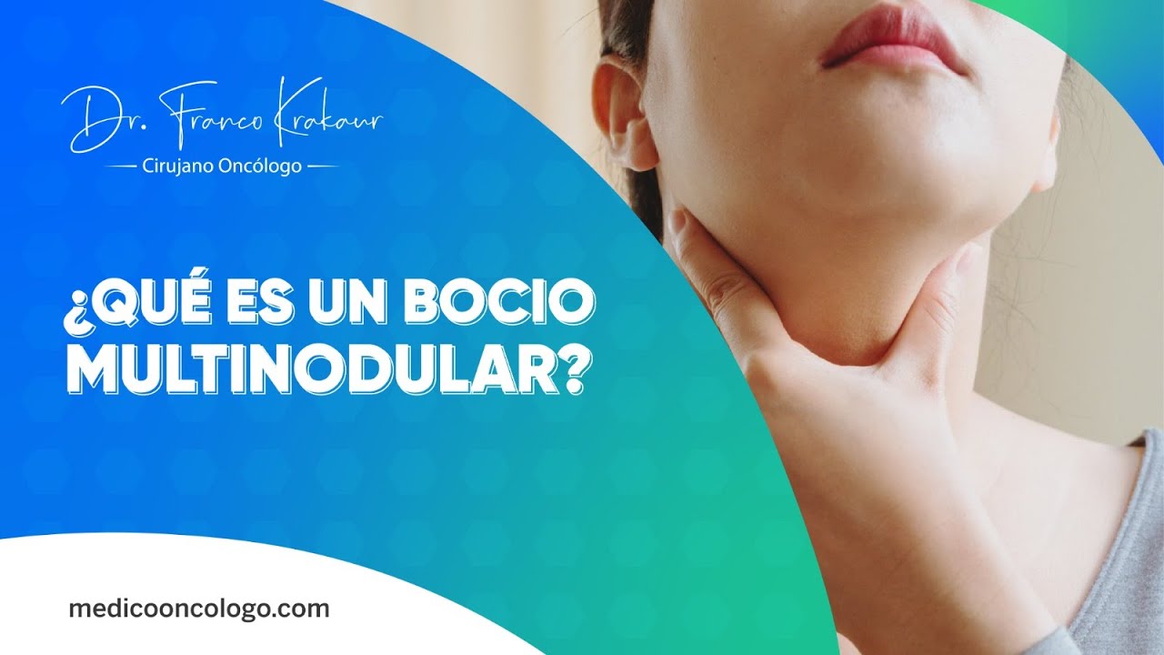 Franco Krakaur García-16