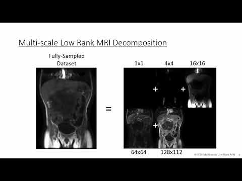 Compressed Sensing MRI with Multiscale Low Rank