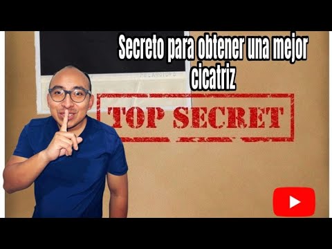 Punto intradérmico o subcuticular. El secreto para obtener una mejor cicatriz