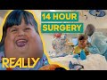 Doctor Operates A 5-Year-Old Girl's Life-Threatening Tumour |  Body Bizarre