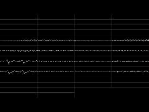 Namco System 2 - Dragon Saber: After Story of Dragon Spirit - "Story of Dragon Saber" - Oscilloscope