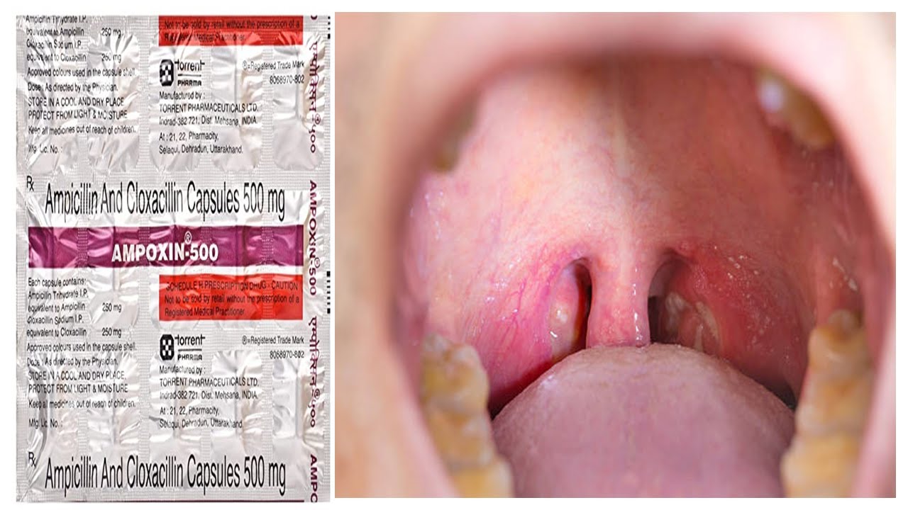 Ampoxin 500 Capsule = Ampicillin (250mg) + Cloxacillin (250mg) = एंटीबायोटिक दवा कैसे काम करता है