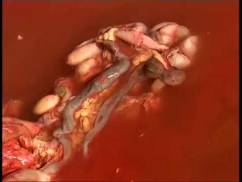 Hidden Hands – A Different History of Modernism – episode 2: A Clean White World